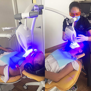 Safe, Effective Teeth Whitening | Pelago Dental